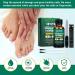 XIFEPFR Toenail Repair Treatment - Extra Strength Nail Renewal Solution for Thick, Brittle, and Discolored Nails - Buy Online on SooperMarket.com