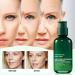 Hyaluronic Acid Facial Serum Hyaluronic Acid Serum Anti Wrinkle Serum Dark Spot Remover for Face Hyaluronic Acid Face Serum for Women Face Moisturiser Skin Tightening Hydrating Plump Skin - Buy Online on SooperMarket.com