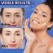 Anti-Wrinkle Tape - Myofascial Lift Tape for Firming Toning & Tightening | Skin-Lifting Face Neck & Forehead Patches - 2 Rolls for Anti-Aging & Wrinkle Reduction - Buy Online on SooperMarket.com