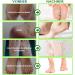 P-Beauty Footmaster Aloe - Intensive Foot Care Peeling Socks | Remove Rough Skin Cracks & Calluses | 5 Pairs for Silky Soft Feet - Buy Online on SooperMarket.com