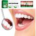 Funnaura Teeth Filling Repair Kit Permanent with Tweezers Temporary Tooth Filler for Missing Broken Fake Chipped Toothy - Buy Online on SooperMarket.com