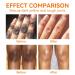 Dark Spot Corrector Cream - Underarm Knee Elbow & Intimate Skin Treatment - 4.21oz - Buy Online on SooperMarket.com
