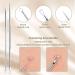 Pimple Popper Blackhead Remove Tool Comedone Extractor Tweezers Set Stainless Steel Acne Spot Pimple Popping Kit with Box(5 Piece) - Buy Online on SooperMarket.com