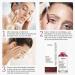 AHA 30% + BHA 2% Peeling Solution - Anti-Acne Serum & Chemical Peel for Face | BHA Liquid Exfoliant for Blemishes & Wrinkles - 1 Floz - Buy Online on SooperMarket.com