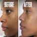 Dark Spot Corrector Serum - Remove Stubborn Dark Spots with Kojic Acid & Alpha Arbutin | Brightening Discoloration Remover for Face - Buy Online on SooperMarket.com