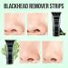 Black Head Remover Charcoal Peel Off Mask - Deep Cleansing Pore & Acne Treatment for All Skin Types - Buy Online on SooperMarket.com