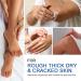 Urea Cream 45% with Salicylic Acid 2% - Intense Moisturizer for Dry Cracked Feet & Hands | Nourishing Foot Cream 1.7 fl.oz - Buy Online on SooperMarket.com