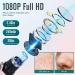 Blackhead Remover Tools with Camera | Pore Cleaner Kit for iPhone, iPad & Android | 20X Magnification | Visible Results - Buy Online on SooperMarket.com