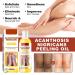 Extra Strong Peeling Oil - Chemical Exfoliant for Face & Body | Reduces Wrinkles Stretch Marks & Dead Skin - Buy Online on SooperMarket.com