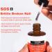 Broken & Brittle Nail Treatment - Multi-purpose Nail Strengthener - Strengthening Hardening Conditioner - Extreme Strength Nail Serum - Quick Help for Split Brittle and damaged Nails 15ML - Buy Online on SooperMarket.com