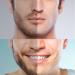 Philips Series 5000 Compatible Shaving Heads - 3PC Replacement Blades for PT860 PT725 PT815 AT810 AT750 - Ultimate Men's Shaver Accessories - Buy Online on SooperMarket.com