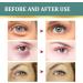 Jasmine Ointment for Dark Circles Active Jasmine Ointment Jasmine Ointment for Drooping Eyelids Active Jasmine Ointment With Collagen And Aloe Vera Jasmine Ointment Plus Jasmine Eye Cream 100ML - Buy Online on SooperMarket.com