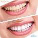 8 Pieces Teeth Whitening Mouth Trays Thermoplastic Teeth Trays Thermoforming Teeth Guards Mould Dental Oral Care Kit for Teeth Whitening Teeth Bleaching Teeth Grinding Teeth Protecting - Buy Online on SooperMarket.com