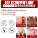 Bexdug Foot Peeling Mask - Exfoliating Peeling Socks for Soft Smooth Feet | Moisturizing Treatment & Dead Skin Remover | Heel Repair | 1 Piece - Buy Online on SooperMarket.com