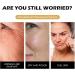 Snail Mucin Moisturiser Snail Cream Snail Mucin Cream with Hydrolyzed Collagen and Snail Filtrate Extract Anti Aging Face Cream for Hydrating Anti Wrinkles - Smooth Fine Lines - Anti Aging - Buy Online on SooperMarket.com