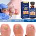 Extra Strength Toe Nail Fungus Treatment - Effective Nail Repair Solution for Healthy Nails - Buy Online on SooperMarket.com