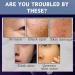 Trendyfave Collagen Cream Collagen Face Cream Anti Aging Cream Collagen Anti-Wrinkle Cream Anti Aging Face Cream Anti-Wrinkle Cream for Lifting for Face Forehead Crow s feet Neck 50g - Buy Online on SooperMarket.com
