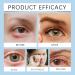 Stye Eye Treatment & Chalazion Remover | Eye Relief Serum & Gentle Lash Cleanser - Fast International Shipping - Buy Online on SooperMarket.com