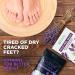 Lavender Oil Foot Soak with Epsom Salt for Dry Cracked Feet - Made in USA - 1 LB Lavender - Softens Calluses, Soothes Sore Feet & Removes Odor - Athlete's Foot Relief - Buy Online on SooperMarket.com