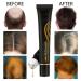 20ml Organic Hair Regrowth Serum Roller Set | Herbal Scalp Intense Roll-On for Men & Women | Triple Massager Hair Growth Essence (3PCs) - Buy Online on SooperMarket.com