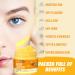 Buy Turmeric & Kojic Body Butter - Natural Skin Brightening Lotion for Even Tone Scars & Age Spots - Whipped Shea Butter Cream - Buy Online on SooperMarket.com