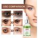 Eye Serum For Firm Skin & Tight Around Eye Eye Serum For Dark Circles & Puffy Eyes Bags Under Eyes Treatment For Women & Men Anti Wrinkle & Anti Aging Eye Serum Reduce Fine Lines - Buy Online on SooperMarket.com