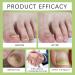 Nail Nourishing Solution | Multifunctional Nail Repair Drops | Nail Strengthening Drops | Hydrating Nail | Natural Nail Repair Remedy |-Infused Nail - Buy Online on SooperMarket.com