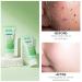 Deep Cleansing Aloe Vera Peeling Gel | Brightening Exfoliating Face Scrub for Acne & Dark Spots - International Shipping - Buy Online on SooperMarket.com