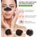 Nose Strips 20 Pcs for Blackheads - Deep Cleansing Pore Strips for Men & Women - Blackhead Remover - Buy Online on SooperMarket.com