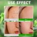 Tea Tree Face Scrub Face Exfoliator Tea Tree Body Scrub Body Exfoliator Moisturizing Body Spa Care Face Skin Care Scrub For Bikini Area Neck Butt Back Acne Armpit Dry & Dull Skin - Buy Online on SooperMarket.com