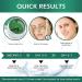 VANELC Eye Mask - Collagen Seaweed Under Eye Patches for Dark Circles Puffiness & Wrinkles | Natural Eye Treatment Gel - Buy Online on SooperMarket.com
