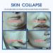 V Line Lifting Face Mask V Shape Lifting Face Masks Skincare with Hyaluronic Acid Chin Lift Mask Firming Lifting Facial Mask Hydrating Double Chin Reducer Moisturizing Face Slimmer - Buy Online on SooperMarket.com