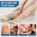 Fungal Nail Treatment Serum Extra Strong Antifungal Nail Treatment for Toenails/Fingernails Improve Thickening/Yellowed/Discolored Nails Original(nail Fungal Serum) - Buy Online on SooperMarket.com
