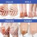 Urea Foot Cream Foot Cream for Cracked Heels and Dry Skin Cracked Heel Repair Cream Callus Remover Foot Moisturiser Natural Moisturizes Nourishes Softens Hand & Feet Care - Buy Online on SooperMarket.com