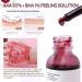 AHA 5% + BH_A 1% Peeling Solution Smooth Skin Exfoliating Facial Serum -Acid Serum For Acne Blackheads & Open Pores Blackhead Remover Reduces Excess Oil & Bumpy Texture 32ml  - Buy Online on SooperMarket.com