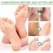 Trendyfave Foot Care Cream Foot Cream For Cracked Heels And Dry Skin Cracked Heel Repair Cream With Vitamin C And Aloe Vera For Deep Moisturizing Callus Remover And Soften Skin Care Hands & Feet - Buy Online on SooperMarket.com