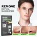 JVR Nose Strips for Blackhead Removal | Deep Cleansing Pore Strips with Charcoal & Witch Hazel | 10 Count for Oily Skin - Buy Online on SooperMarket.com
