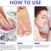 Toen il Correction Sticker 100Pcs: N il Repair P tches Restores Appearance of Discolored or Damaged Nails Foot Care - Buy Online on SooperMarket.com