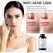 Face Moisturiser Retinoid 2% Emulsion Retinol Serum High Strength for Face Retinol Face Serum Anti Wrinkle Serum Fade Fine Lines Acne Reduced Skin Repair Serum for Women & Men 30ml 1PC Retinoid 2% Emulsion - Buy Online on SooperMarket.com