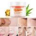 Dark Skin Peeling Oil and Dark Spot Correcting Cream - Extra Strength Exfoliating Solution - Buy Online on SooperMarket.com