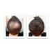 Dark Brown Hair Loss Concealer Trial Size - Cover Bald Spots Instantly - 10-Day Supply - All-Natural Fiber Formula - Buy Online on SooperMarket.com