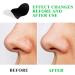 80 Pcs Nose Strips Pore Blackhead Remover Strips Nose Charcoal Bamboo Deep Cleansing of Blackheads Remover to All Skin Types Nose Blackhead Removal Skin Care at Home for Women Men(Black) - Buy Online on SooperMarket.com