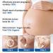 Belly Oil 90PCS | Stretch Mark Oil for Pregnancy | Improve Skin Elasticity & Nourish | Massage Oil for Moms - Buy Online on SooperMarket.com