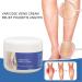 50g Natural Varicose Veins Cream | Leg Circulation & Spider Vein Remover | Cooling Effect | Ointment - Buy Online on SooperMarket.com