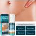 Scar Repair Gel 50ml - Mild Grease-Free Formula for Fading Scars, Wrinkles, Age Spots - Skin Soothing & Absorbing Cream - Buy Online on SooperMarket.com