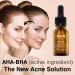 SKIN LABO SkinLabo Active Serum Aha + Bha Eliminates Surface Dead Cells Skin Perfecter with Exfoliating and Purifying Action 15 ml (Old Version) - Buy Online on SooperMarket.com