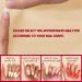 240PCS Medium Almond Gel Nail Tips Set - Pre-Buffed & Soft | Nail Extensions Kit for All Nails - Buy Online on SooperMarket.com