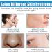 Repairing Face Cream Smoothing Day Cream Anti-Redness Moisturising Cream Firming Face Cream for Sensitive Skin Vitamin B5 Cream Against Acne Brightening & Skin Repair - Buy Online on SooperMarket.com