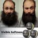 Waking Forest Beard Balm Kit for Men | All-Natural Thicker Beard Growth Butter & Softener | Ultimate Moisturizer Beard Growth Kit - Buy Online on SooperMarket.com