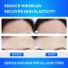 SILKDERMIS Forehead Wrinkle Patches - 12 Pack Anti Wrinkle Patches with Aloe, Collagen & Vitamin E for Forehead Wrinkles Treatment - Buy Online on SooperMarket.com
